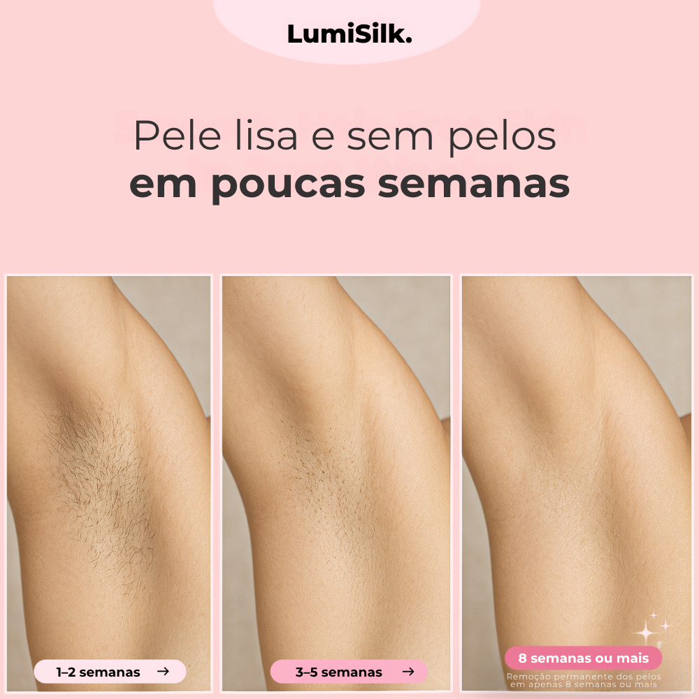 Resultados antes e depois com Lumina – pele lisa e sem pelos em apenas 8 semanas usando tecnologia IPL.